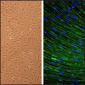 Rat Brain Microvascular Endothelial Cells: RBMVEC, adult R840-05A