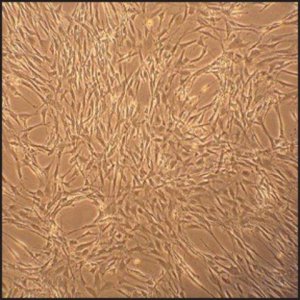 Rat Skeletal Muscle Cells: RSkMC, adult R150-05A