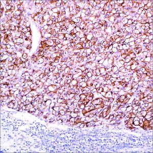 Carbonic Anhydrase IX (CA IX) (EP161) Rabbit Monoclonal Primary Antibody 