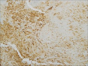 Cytokeratin 5 & 6 (EP24 & EP67) Rabbit Monoclonal Primary Antibody 