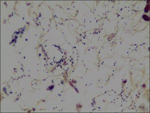 Gram stain for tissue HT90T-1KT