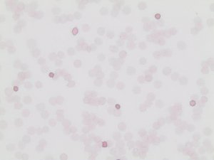 Acid hematoxylin solution 