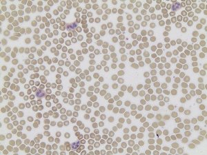 Acid Phosphatase, Leukocyte (TRAP) Kit 387A-1KT