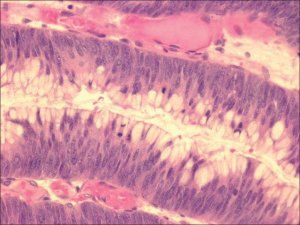 Hematoxylin Solution, Mayers MHS32-1L