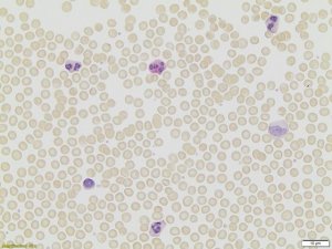 Leukocyte Alkaline Phosphatase Kit 86R-1KT