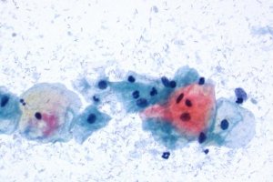 Papanicolaous solution 3c Polychromatic solution EA 65 1092700100