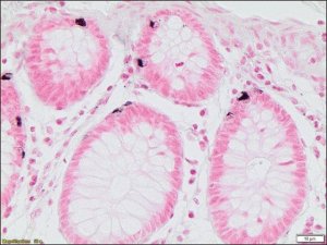 Argentaffin TISSUE-TROL Control Slides TTR013-25EA