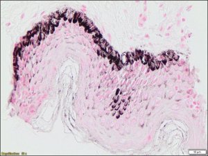 Melanin TISSUE-TROL Control Slides TTR014-25EA