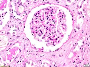 PAS TISSUE-TROL Control Slides 