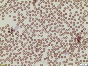 Peroxidase (Myeloperoxidase) Leukocyte Kit 390A-1KT