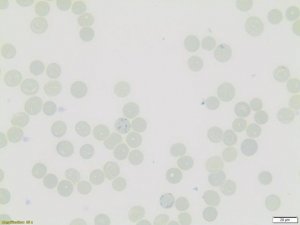 Reticulocyte Stain R4132-120ML