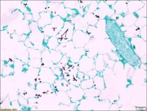 Silver methenamine 