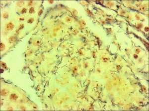 Spirochetes TISSUE-TROL Control Slides 
