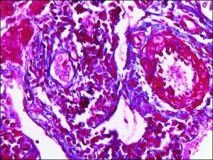 Trichrome Stain AB solution HT10516-500ML