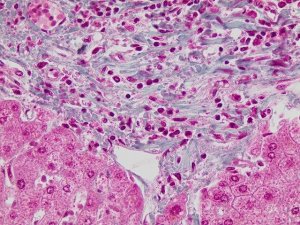 Trichrome stain LG solution HT10316-500ML