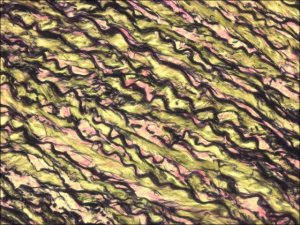 Van Gieson Solution Acid Fuchsin 