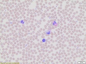 Wright-Giemsa Stain, Modified WG128-4L