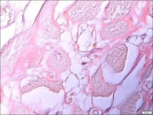 Amyloid Stain, Congo Red Kit HT60-1KT