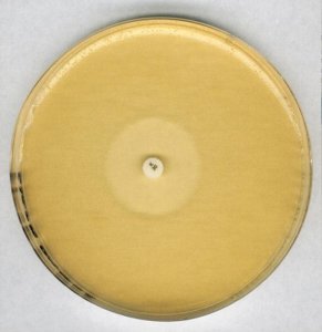 Antibiotic agar no. 11 
