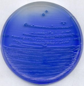 China-blue lactose agar 