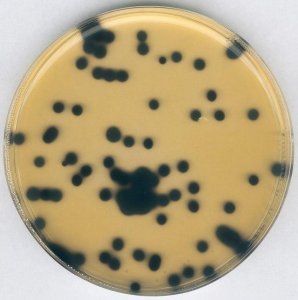 Clostridium perfringens selective supplement 