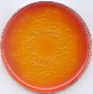 Deoxycholate lactose agar 