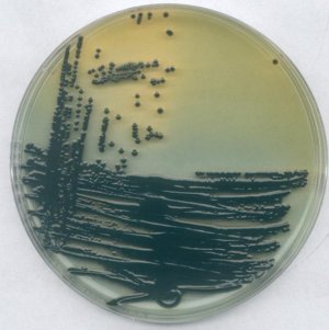 E.coli 0157:H7-Agar 