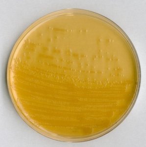 ECD agar 