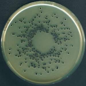 Egg yolk tellurite emulsion 