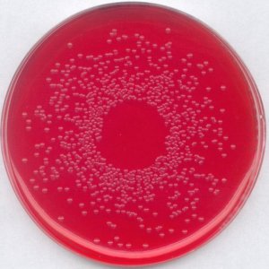 GranuCult BPLS agar, modified 