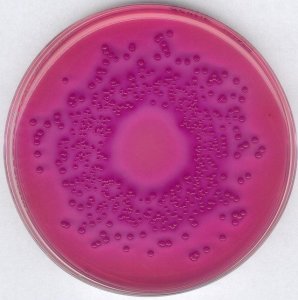 GranuCult VRBD (Violet Red Bile Dextrose) agar 