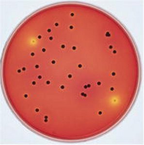 GranuCult XLT4 agar (Base) 