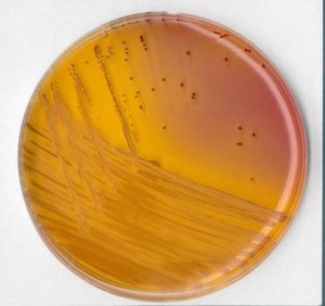 KF streptococcus agar (base) 