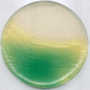 KING agar B (base) (Dansk Standard) 
