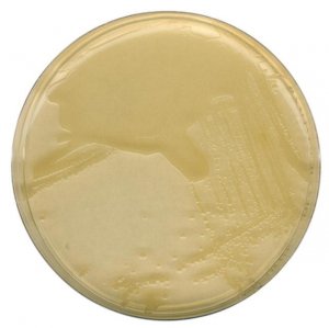LB agar (MILLER) 
