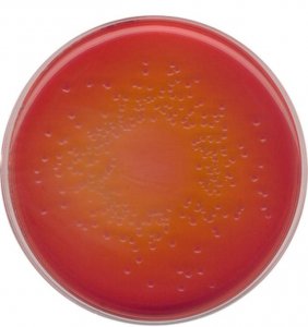 MacConkey Agar 