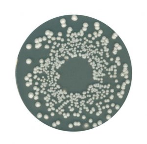 Orange Serum agar 