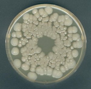 Orange Serum agar 