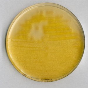 Pseudomonas agar F (base) 