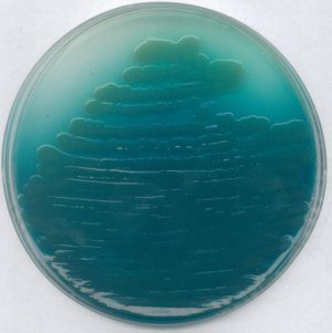 Pseudomonas agar P (base) 