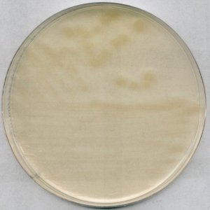 R2A Agar 