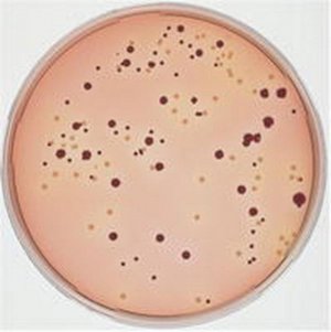 SMAC agar base 