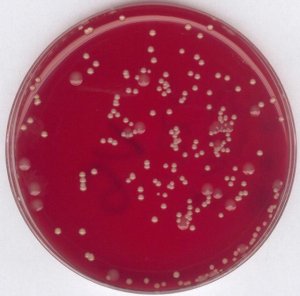 Staphylococcus enrichment broth (base) acc. to BAIRD 