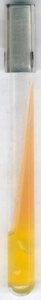 Urea agar (Base) acc. CHRISTENSEN 