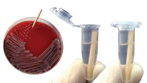smartPick Wooden inoculation picks 