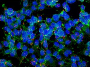 Anti-Proteus vulgaris antibody, Mouse monoclonal 