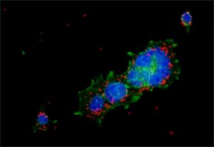 Anti-Proteus vulgaris LPS antibody, Mouse monoclonal 