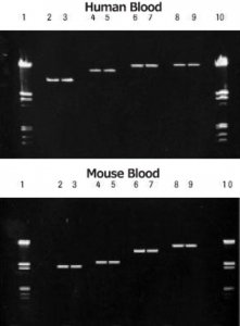 DNA Isolation Kit for Mammalian Blood 11667327001