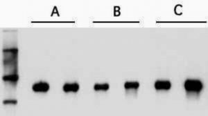 mRNA Isolation Kit for Blood/Bone Marrow 11934333001