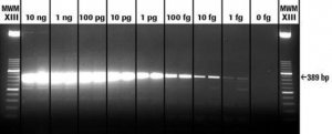 Transcriptor One-Step RT-PCR Kit 